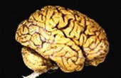 Как устроен мозг человека