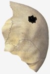 Рисунок простреленного фрагмента черепа