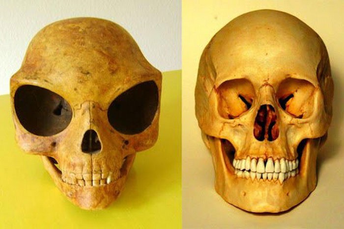 Инопланетный череп Силенда и череп человека